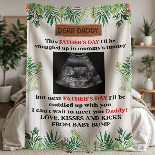 Custom Ultrasound Blanket – Father’s Day Gift from Baby Bump !