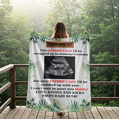 Custom Ultrasound Blanket – Father’s Day Gift from Baby Bump !